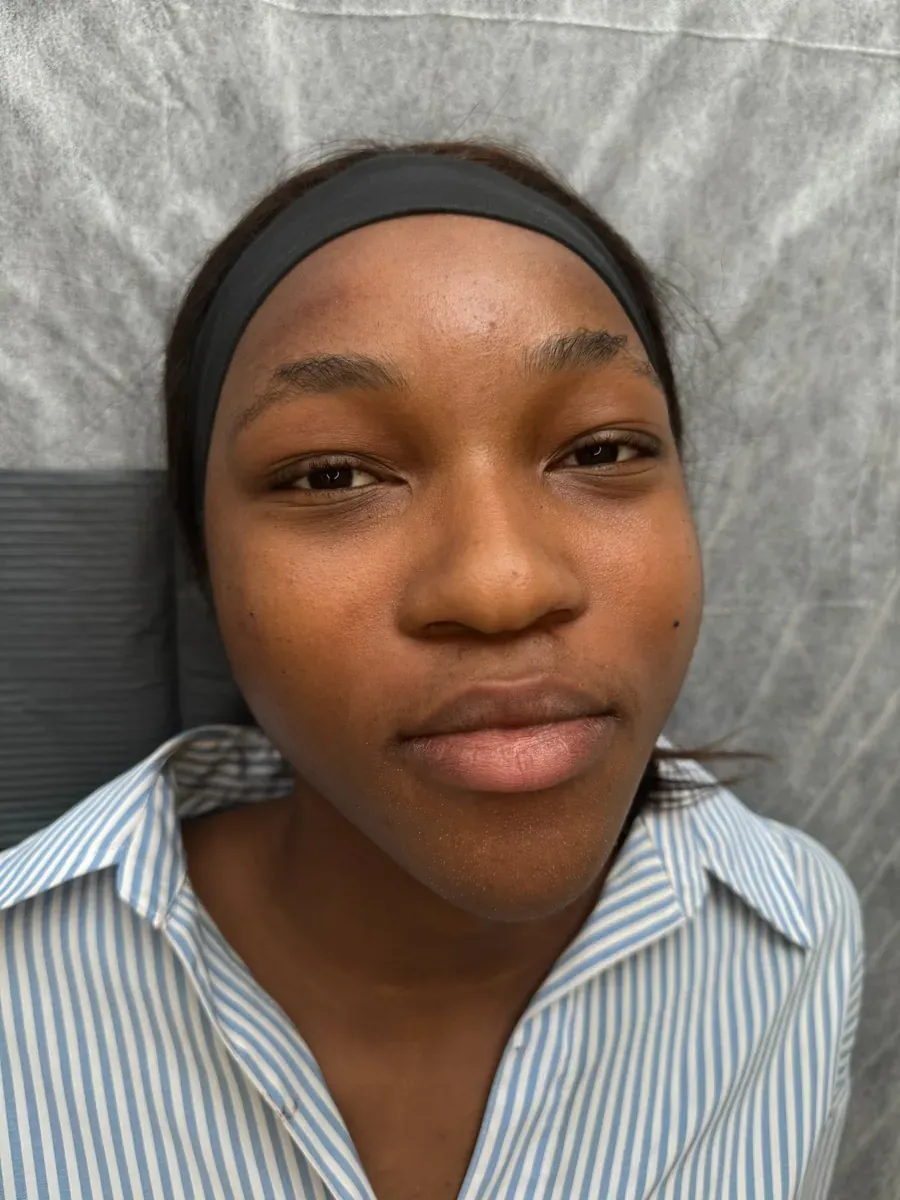Client with Black skin and no brow tail, before powder brows